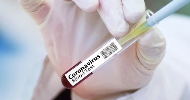 Coronavírus, teste